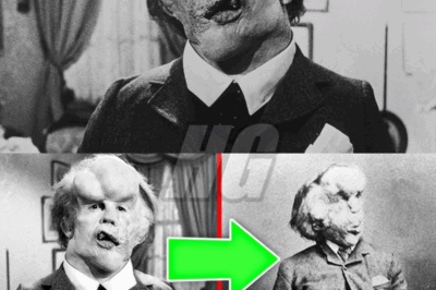 Have You Heard of Joseph Merrick, The Man Who Inspired ‘The Elephant Man’? This Is His TRAGIC Story