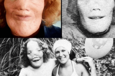 The Truth About Rocky Dennis